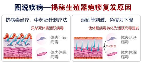 生殖器疱疹硬块